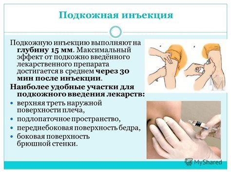 Альтернативные места инъекции мильгаммы