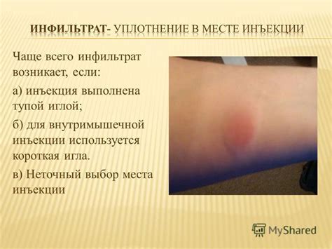Выбор места инъекции мильгаммы для собаки