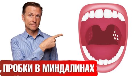 Как предотвратить появление белого налета на укропе