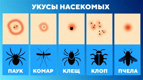 Охрана от укусов насекомых: правильная ротация дивана