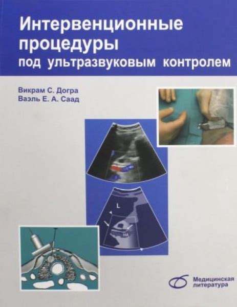 Подробное описание процедуры