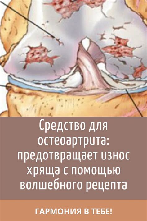 Предотвращает износ