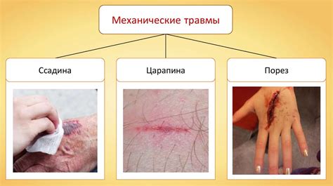 Причина №2: Механическое повреждение