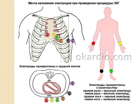 Проведение самого процесса ксерокопирования ЭКГ