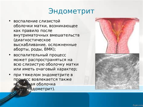 Симптомы и последствия утолщенной слизистой оболочки матки