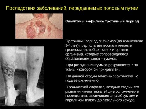 Симптомы узлов и их последствия