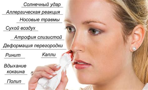 Смысл крови из носа